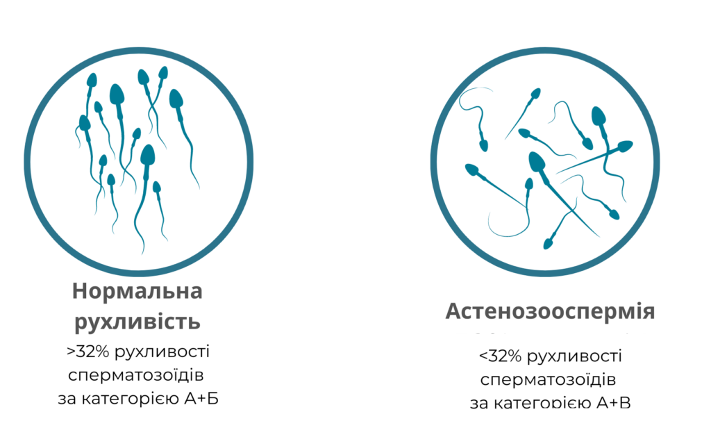 астенозооспермія